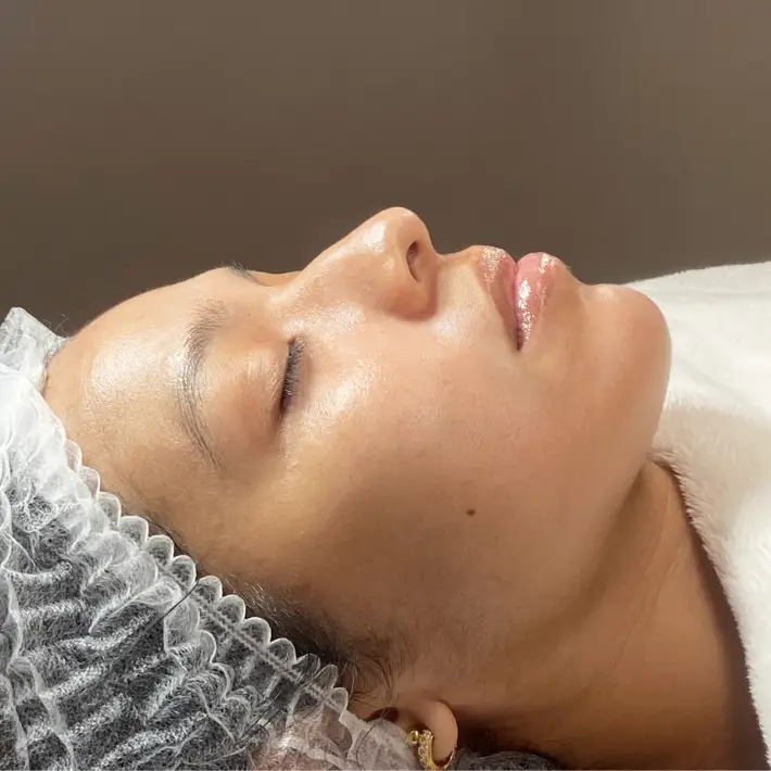 Efecto Glow Inmediato